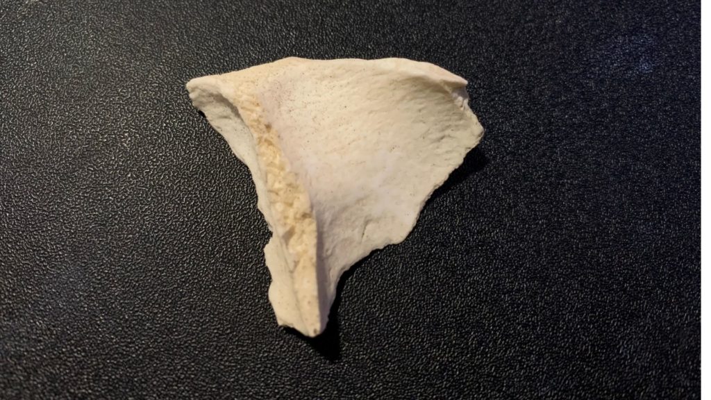 A bone fragment.