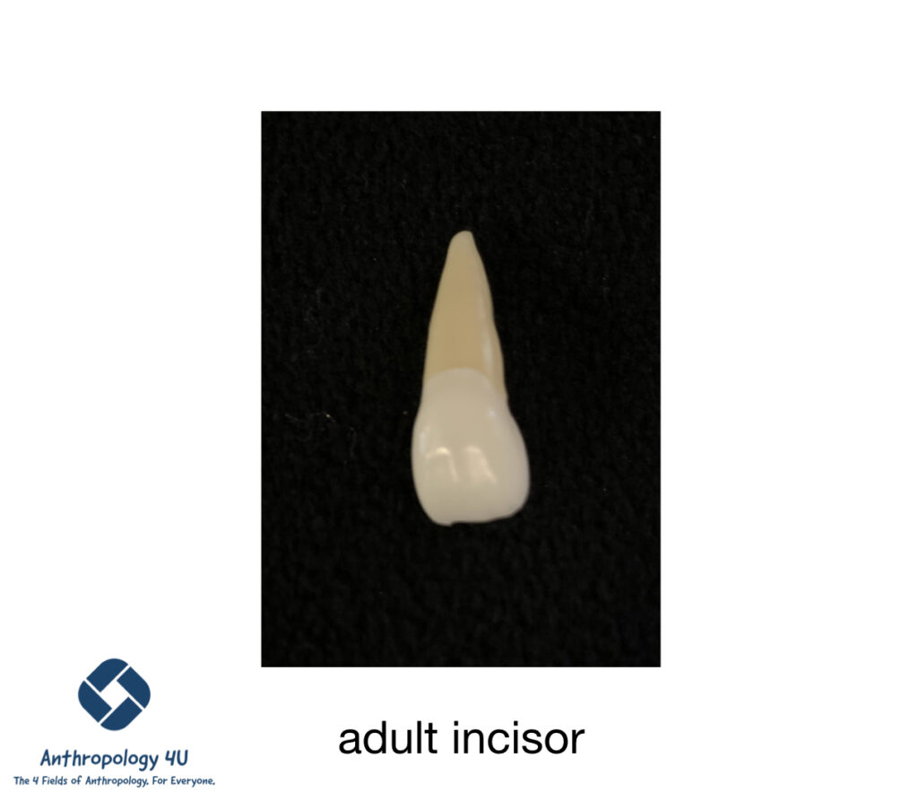 Forensic Anthropology & Teeth. Image of an adult incisor tooth.
